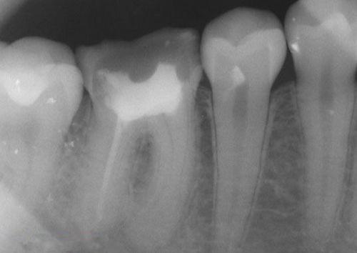 中國再生牙齒研究新進展，重塑微笑，科技引領牙齒再生新篇章