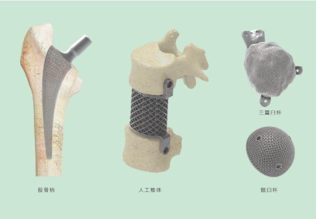 三維打印髖關(guān)節(jié)技術(shù)新動態(tài)，重塑生活的科技魔法奇跡